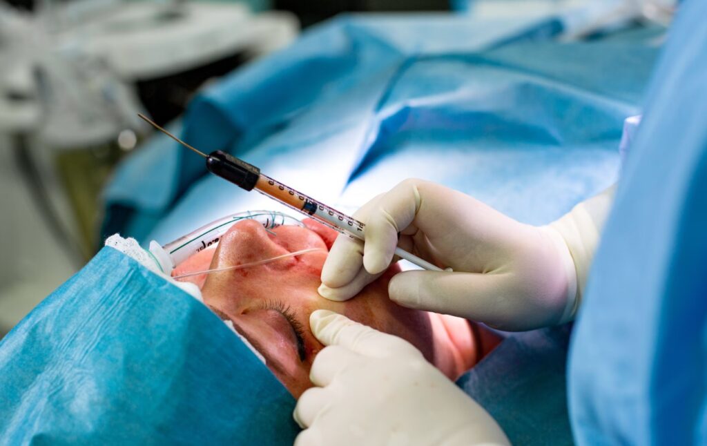 Facial Fat Grafting